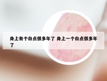 身上有个白点很多年了 身上一个白点很多年了