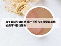 扁平苔藓与银屑病 扁平苔癣与寻常型银屑病的病理特征性鉴别