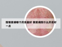 擦银屑病哪个药膏最好 银屑病擦什么药膏好一点