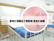 苦杏仁泡醋冶了银屑病 苦杏仁加醋