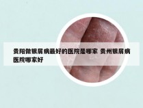 贵阳做银屑病最好的医院是哪家 贵州银屑病医院哪家好