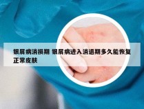 银屑病消损期 银屑病进入消退期多久能恢复正常皮肤