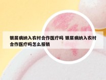 银屑病纳入农村合作医疗吗 银屑病纳入农村合作医疗吗怎么报销