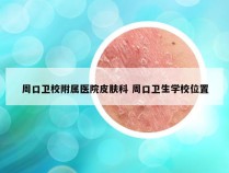 周口卫校附属医院皮肤科 周口卫生学校位置