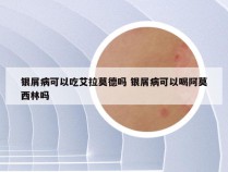 银屑病可以吃艾拉莫德吗 银屑病可以喝阿莫西林吗