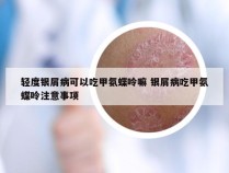 轻度银屑病可以吃甲氨蝶呤嘛 银屑病吃甲氨蝶呤注意事项