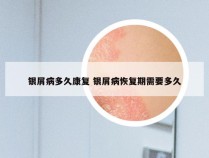银屑病多久康复 银屑病恢复期需要多久