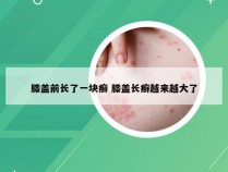 膝盖前长了一块癣 膝盖长癣越来越大了