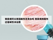 银屑病可以用弱酸性洗发水吗 银屑病用酸性还是碱性沐浴露