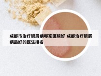 成都市治疗银屑病哪家医院好 成都治疗银屑病最好的医生排名