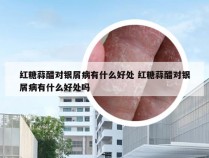 红糖蒜醋对银屑病有什么好处 红糖蒜醋对银屑病有什么好处吗