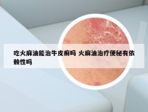 吃火麻油能治牛皮癣吗 火麻油治疗便秘有依赖性吗