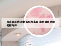 南京银屑病l现代长城专家好 南京银屑病研究所咋样