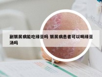 副银屑病能吃绿豆吗 银屑病患者可以喝绿豆汤吗
