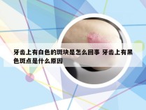 牙齿上有白色的斑块是怎么回事 牙齿上有黑色斑点是什么原因