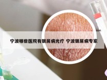 宁波哪些医院有银屑病光疗 宁波银屑病专家