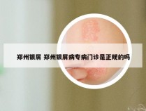 郑州银屑 郑州银屑病专病门诊是正规的吗