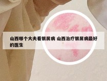 山西哪个大夫看银屑病 山西治疗银屑病最好的医生