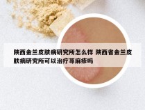 陕西金兰皮肤病研究所怎么样 陕西省金兰皮肤病研究所可以治疗荨麻疹吗