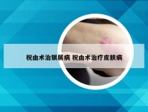 祝由术治银屑病 祝由术治疗皮肤病