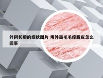 外阴长癣的症状图片 阴外面毛毛痒脱皮怎么回事