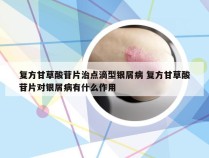 复方甘草酸苷片治点滴型银屑病 复方甘草酸苷片对银屑病有什么作用