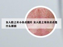 女人脸上长小白点图片 女人脸上有白点点是什么原因