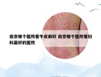 南京哪个医院看牛皮癣好 南京哪个医院看妇科最好的医院