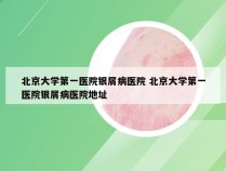 北京大学第一医院银屑病医院 北京大学第一医院银屑病医院地址