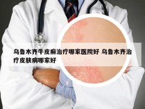 乌鲁木齐牛皮癣治疗哪家医院好 乌鲁木齐治疗皮肤病哪家好