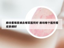 廊坊看银屑病去哪家医院好 廊坊哪个医院看皮肤病好