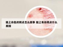 腿上白色的斑点怎么回事 腿上有白斑点什么原因