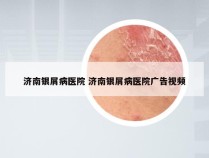 济南银屑病医院 济南银屑病医院广告视频