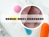银屑病泡澡一般跑多久 银屑病泡澡有用吗