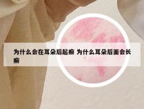 为什么会在耳朵后起癣 为什么耳朵后面会长癣