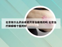 北京有什么药水或者药膏治癣用的吗 北京治疗脚癣哪个医院好