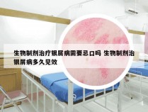 生物制剂治疗银屑病需要忌口吗 生物制剂治银屑病多久见效