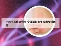 宁波牛皮癣研究院 宁波最好的牛皮癣专科医院