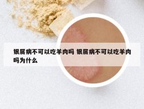 银屑病不可以吃羊肉吗 银屑病不可以吃羊肉吗为什么