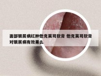 面部银屑病红肿他克莫司软膏 他克莫司软膏对银屑病有效果么