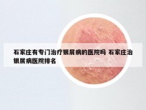 石家庄有专门治疗银屑病的医院吗 石家庄治银屑病医院排名