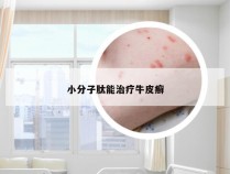 小分子肽能治疗牛皮癣