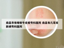 南昌市有哪些牛皮癣专科医院 南昌有几家皮肤病专科医院