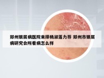 郑州银屑病医院来择杨淑莲力荐 郑州市银屑病研究会所看病怎么样