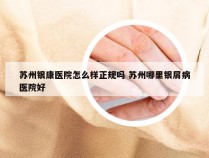 苏州银康医院怎么样正规吗 苏州哪里银屑病医院好