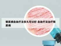 银屑病自血疗法多久可以好 自血疗法治疗银屑病