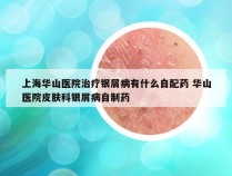 上海华山医院治疗银屑病有什么自配药 华山医院皮肤科银屑病自制药