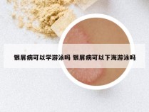 银屑病可以学游泳吗 银屑病可以下海游泳吗