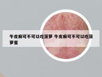 牛皮癣可不可以吃菠萝 牛皮癣可不可以吃菠萝蜜