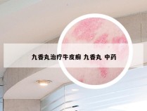 九香丸治疗牛皮癣 九香丸 中药